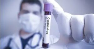 test-chloroquine-luxembourg
